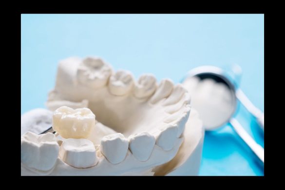 Understanding Why Your Dental Crown Hurts When Biting Down